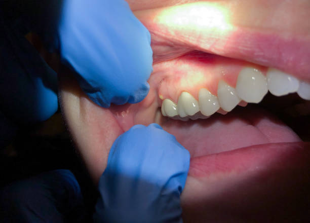 Best Emergency Dental Services for Seniors in Sonoma, CA