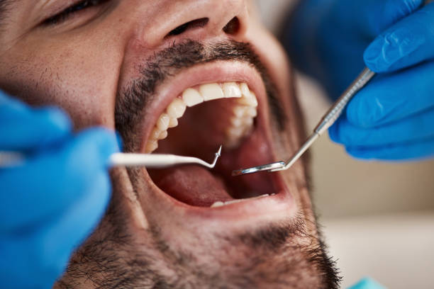 Best Emergency Cosmetic Dentistry in Sonoma, CA